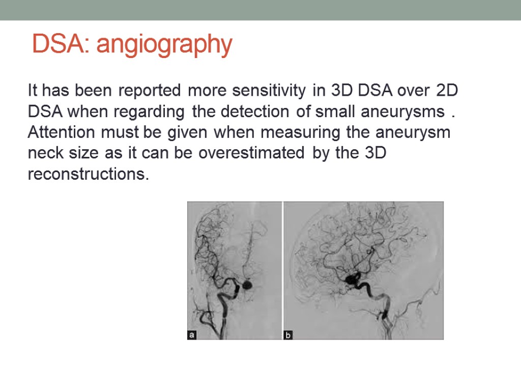 DSA: angiography It has been reported more sensitivity in 3D DSA over 2D DSA